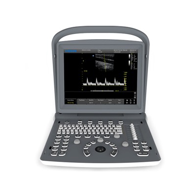 CHISON ECO2 USG iekārta