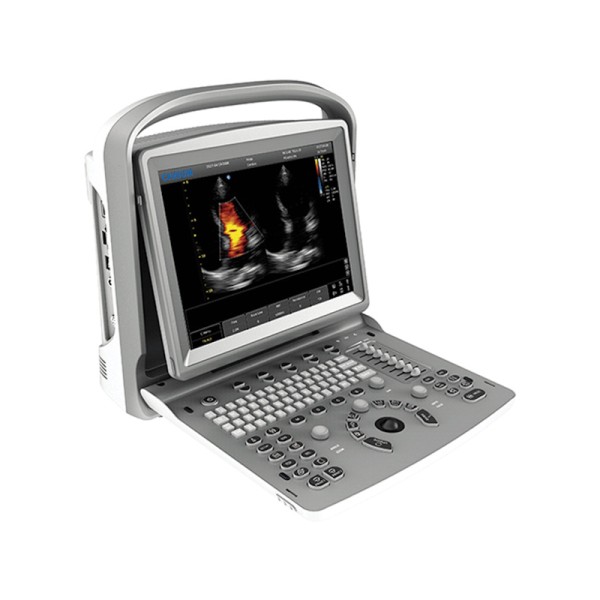 Chison ECO6 ultraskaņas iekārta